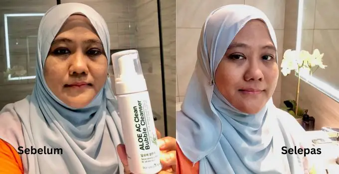 pencuci muka terbaik untuk kulit berminyak